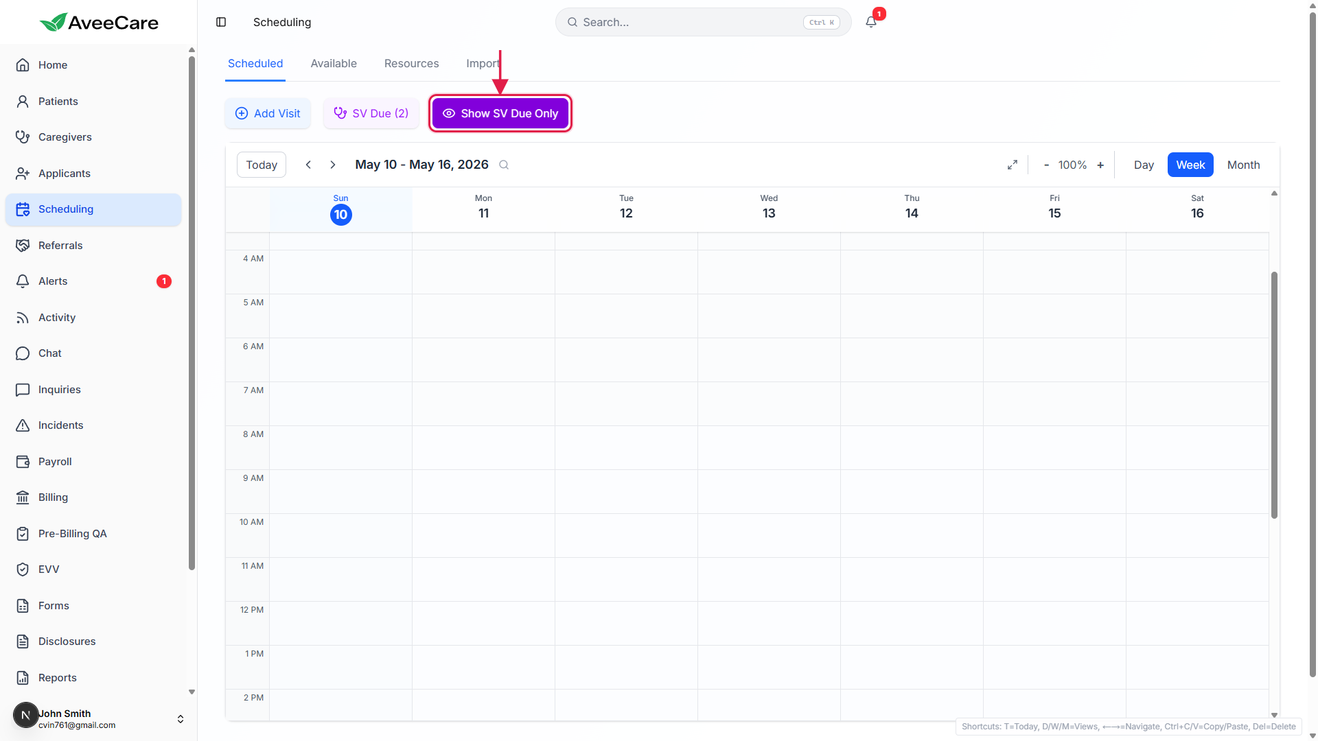 Show SV Due Only toggle in its active purple state, called out with a red box
